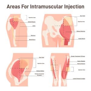 Semaglutide Injection Sites illustration